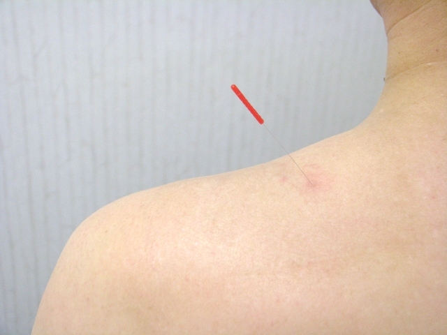 東洋医学一筋!身体の力を引き出し、幅広い症状に対応できますの写真