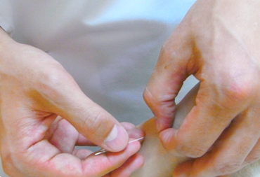 【鍼灸】一覧 ※50%OFFクーポンありの画像